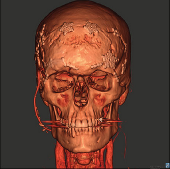 ATF_EX2