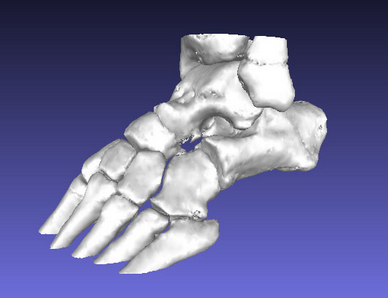 MeshOptimizeFootPost